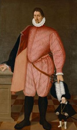 Giovanni Bona. This portrait of the giant Giovanni Bona was initially referred to by Sternberg (1899) as the oldest historical document on acromegaly. This life size portrait, 2.40m, by the court painter of the Elector of the Palatinate, Frederick II, in 1553 was originally held in the Ambras-Schloss in the Tyrol now in the Kunsthistorisches Museum, Vienna. Also include in the picture is the dwarf Thomerle
